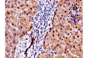 Immunohistochemistry of paraffin-embedded human liver tissue using ABIN7142886 at dilution of 1:100