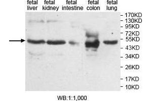 Western blot analysis of various fetal tissue, using AMN antibody. (AMN Antikörper  (Middle Region))