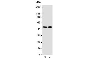 Western blot testing of VDR antibody and Lane 1:  MCF-7