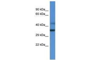 Image no. 1 for anti-Mitochondrial Ribosomal Protein L45 (MRPL45) (AA 227-276) antibody (ABIN6746837)