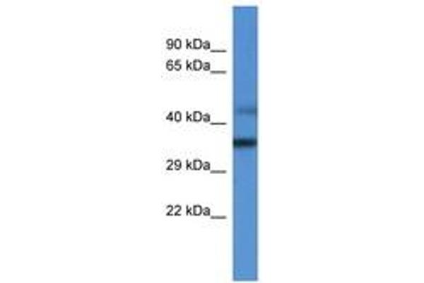 MRPL45 抗体  (AA 227-276)