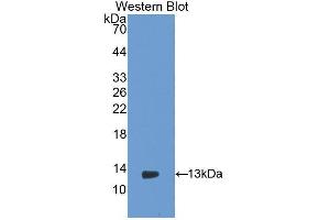 Western blot analysis of the recombinant protein. (PIGR Antikörper  (AA 343-447))