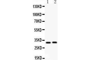 Anti- IL1beta antibody, Western blotting All lanes: Anti IL1beta  at 0.