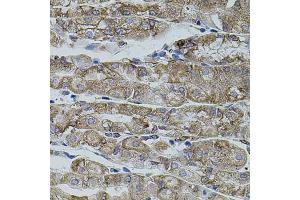 Immunohistochemistry of paraffin-embedded human stomach using SHH antibody (ABIN6291366) (40x lens).