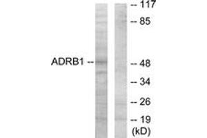 Western blot analysis of extracts from HT-29 cells, using ADRB1 Antibody. (ADRB1 Antikörper  (AA 281-330))