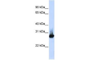 BCAP31 antibody used at 1 ug/ml to detect target protein. (BCAP31 Antikörper  (Middle Region))