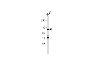 Western Blotting (WB) image for anti-HIR Histone Cell Cycle Regulation Defective Homolog A (HIRA) (AA 32-61), (N-Term) antibody (ABIN1539297)