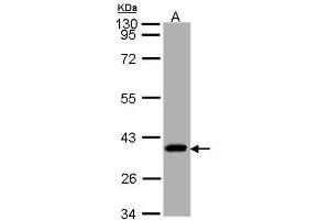 WB Image Sample (30 ug of whole cell lysate) A: A431 10% SDS PAGE antibody diluted at 1:1000 (SUCLG1 Antikörper)