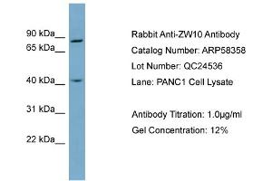 WB Suggested Anti-ZW10  Antibody Titration: 0.