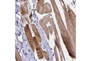 Immunohistochemical staining of human skeletal muscle with HAPLN2 polyclonal antibody ( Cat # PAB28323 ) shows strong cytoplasmic positivity in myocytes. (HAPLN2 Antikörper)