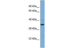 Western Blotting (WB) image for anti-Presenilin 2 (Alzheimer Disease 4) (PSEN2) (C-Term) antibody (ABIN2787885) (Presenilin 2 Antikörper  (C-Term))