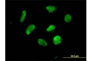 Immunofluorescence of purified MaxPab antibody to ZNF302 on HeLa cell. (ZNF302 Antikörper  (AA 1-399))