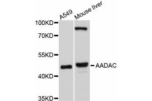 Western blot analysis of extracts of various cell lines, using AADAC antibody (ABIN4902801) at 1:1000 dilution. (AADAC Antikörper)