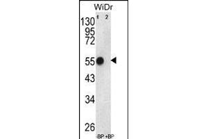 Western blot analysis of ATP5B Antibody (Center) Pab (ABIN650786 and ABIN2839558) pre-incubated without(lane 1) and with(lane 2) blocking peptide in WiDr cell line lysate. (ATP5B Antikörper  (AA 135-163))