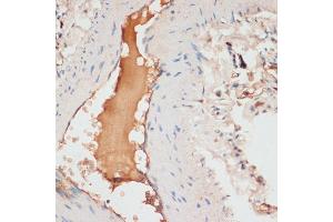 Immunohistochemistry of paraffin-embedded human lung using  antibody (ABIN6127360, ABIN6137012, ABIN6137013 and ABIN6221266) at dilution of 1:100 (40x lens). (APOC1 Antikörper  (AA 1-83))