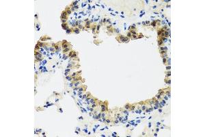 Immunohistochemistry of paraffin-embedded mouse lung using ST6G antibody (ABIN6130083, ABIN6148536, ABIN6148538 and ABIN6221427) at dilution of 1:100 (40x lens). (ST6GAL1 Antikörper  (AA 27-200))