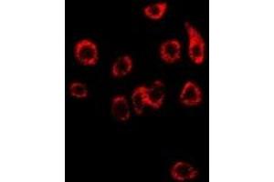 Immunofluorescent analysis of NDRG1 staining in SW480 cells. (NDRG1 Antikörper)
