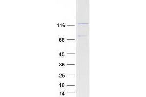 SYCP1 Protein (Myc-DYKDDDDK Tag)