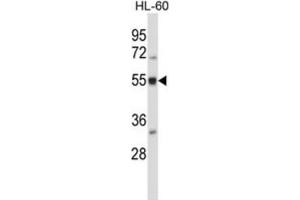 Western Blotting (WB) image for anti-BAI1-Associated Protein 2-Like 2 (BAIAP2L2) antibody (ABIN2997368) (BAIAP2L2 Antikörper)