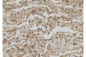 ABIN6272437 at 1/100 staining Human lung tissue by IHC-P. (ZNF280A Antikörper  (C-Term))