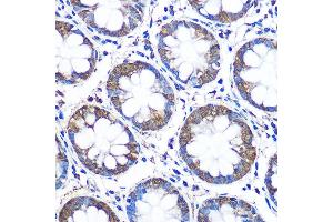 Immunohistochemistry of paraffin-embedded human colon using WISP2 Rabbit pAb (ABIN6128929, ABIN6150227, ABIN6150229 and ABIN6223338) at dilution of 1:100 (40x lens).