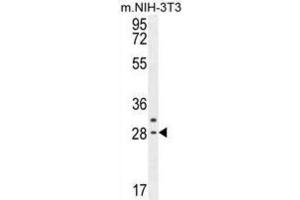 Western Blotting (WB) image for anti-Claudin 22 (CLDN22) antibody (ABIN2995576) (Claudin 22 (CLDN22) Antikörper)