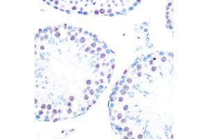 Immunohistochemistry of paraffin-embedded mouse testis using Cyclin H Rabbit mAb (ABIN7266569) at dilution of 1:100 (40x lens). (Cyclin H Antikörper)