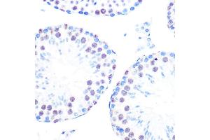 Immunohistochemistry of paraffin-embedded mouse testis using Cyclin H Rabbit mAb (ABIN7266569) at dilution of 1:100 (40x lens). (Cyclin H Antikörper)