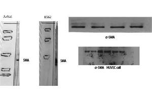 Western Blot (WB) analysis of specific cells using alpha-SMA Polyclonal Antibody. (alpha-SMA (N-Term) Antikörper)