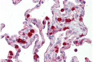 Anti-KAL1 / Anosmin antibody IHC staining of human lung. (Anosmin Antikörper  (Internal Region))
