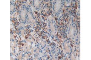 Used in DAB staining on fromalin fixed paraffin- embedded Kidney tissue (MGA Antikörper  (AA 2450-2733))