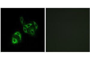 Immunofluorescence analysis of A549 cells, using SLC27A4 antibody. (SLC27A4 Antikörper  (N-Term))