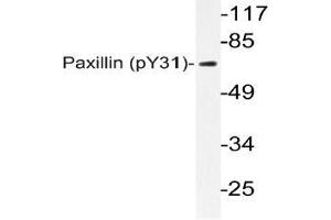 Western blot (WB) analyzes of p-Paxillin (pTyr31) antibody in extracts from HeLa TNF cells. (Paxillin Antikörper  (pTyr31))