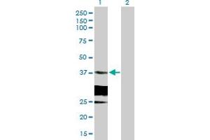 Western Blot analysis of HSD17B6 expression in transfected 293T cell line by HSD17B6 MaxPab polyclonal antibody. (HSD17B6 Antikörper  (AA 1-317))