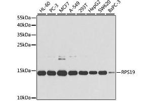 Western blot analysis of extracts of various cell lines, using RPS19 antibody. (RPS19 Antikörper  (AA 1-145))