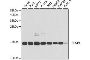 Western blot analysis of extracts of various cell lines, using RPS19 antibody. (RPS19 Antikörper  (AA 1-145))