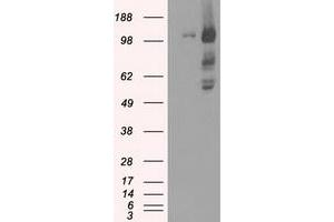 HEK293T cells were transfected with the pCMV6-ENTRY control (Left lane) or pCMV6-ENTRY BUB1B (Right lane) cDNA for 48 hrs and lysed. (BUB1B Antikörper)