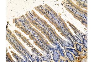 ABIN7096111 and ABIN7100173 at 1/100 staining rat colorectal tissue by IHC-P. (Leiomodin 2 Antikörper)