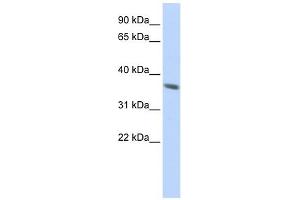 Cytokeratin 222 Pseudogene antibody used at 1 ug/ml to detect target protein. (KRT222 Antikörper  (N-Term))