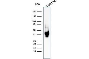 Western Blot Analysis of COLO-38 cell lysate using gp100 Rabbit Polyclonal Antibody (Melanoma gp100 Antikörper)