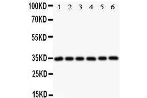 Observed bind size: 33KD (MYD88 Antikörper  (AA 44-264))