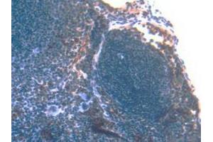 IHC-P analysis of Mouse Spleen Tissue, with DAB staining. (S100A8 Antikörper  (AA 1-89))