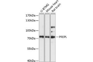 Western blot analysis of extracts of various cell lines, using PREPL antibody (ABIN7269561) at 1:3000 dilution.