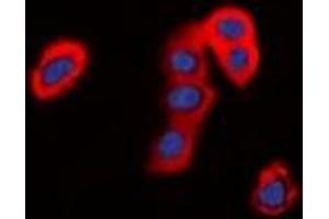 Immunofluorescent analysis of TMEM16J staining in HepG2 cells. (ANO9 Antikörper)
