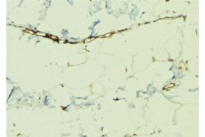 ABIN6268970 at 1/100 staining Human lung tissue by IHC-P. (Dematin Antikörper  (pSer403))