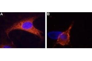 Expression of TRPM8 in rat DRG cells - Immunocytochemistry of rat dorsal root ganglion (DRG) cells. (TRPM8 Antikörper  (3rd Extracellular Loop))