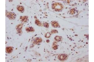 Immunohistochemistry (IHC) image for anti-BCL2-Like 1 (BCL2L1) antibody (ABIN7127365)