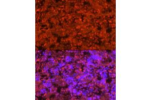 Immunofluorescence analysis of rat bone marrow cells using Neutrophil Elastase (ELANE) Rabbit pAb (ABIN6131604, ABIN6140110, ABIN6140111 and ABIN6216843) at dilution of 1:250 (40x lens). (ELANE Antikörper  (AA 30-267))