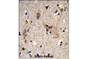 Formalin-fixed and paraffin-embedded human brain tissue reacted with ALDH18A1 Antibody , which was peroxidase-conjugated to the secondary antibody, followed by DAB staining. (P5CS Antikörper  (AA 176-205))