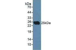 Detection of CD301 in Rat Testis Tissue using Polyclonal Antibody to Cluster Of differentiation 301 (CD301) (CLEC10A Antikörper  (AA 71-239))